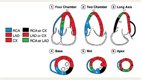 lv wall motion abnormality|basal inferior wall is hypokinetic.